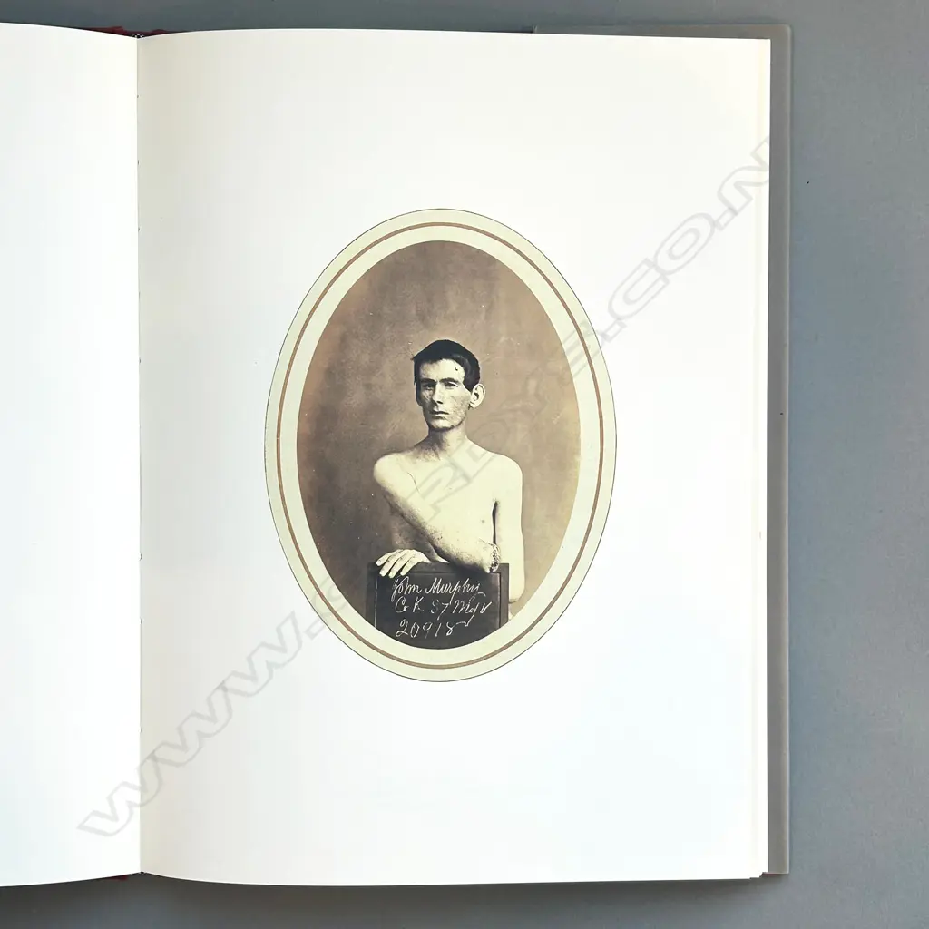 MASTERPIECES OF MEDICAL PHOTOGRAPHY Image 1++